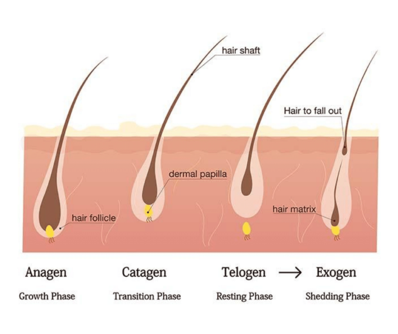 Male Pattern Hair Loss and the Hair Follicle - Harley Men
